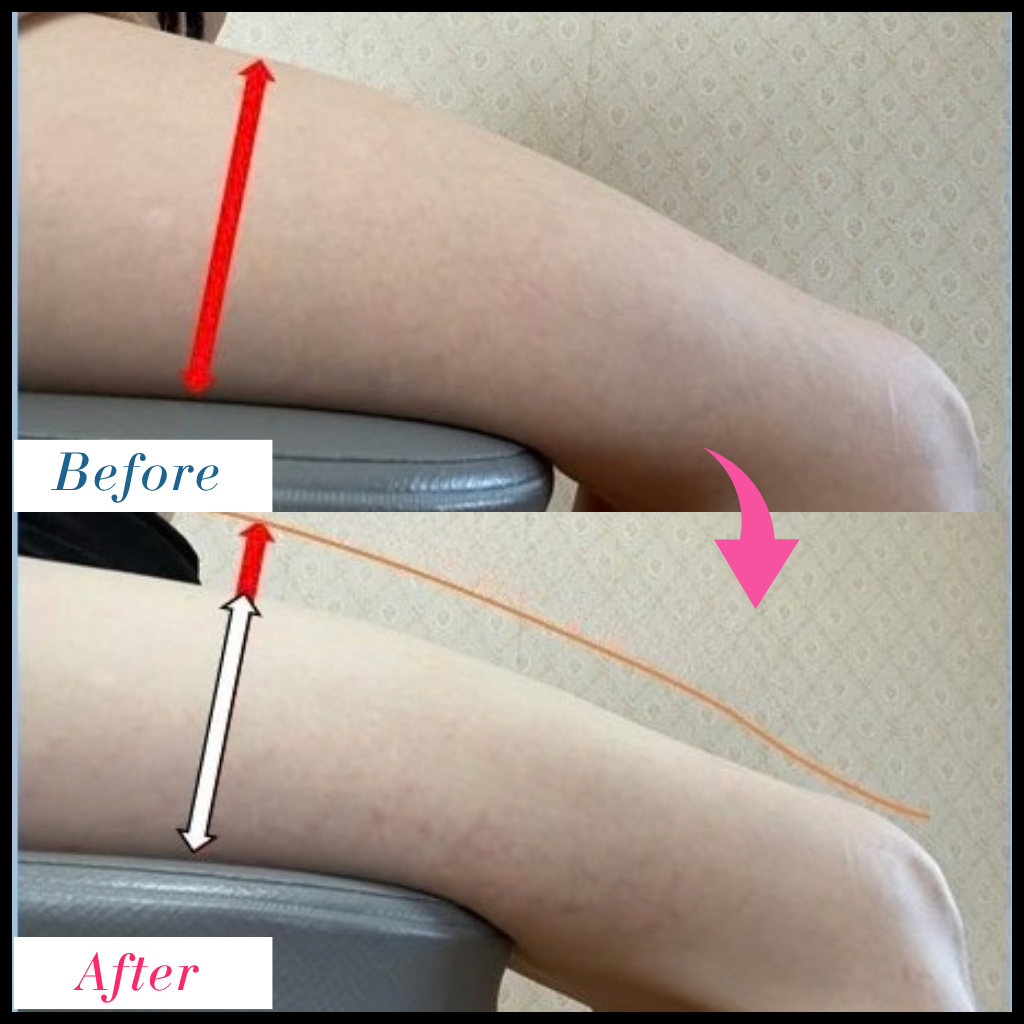 石井いりす Before After