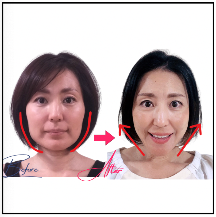 花宮千香子 Before After